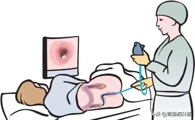 胃肠镜检查前后的注意事项,肠镜检查前后的注意事项是什么