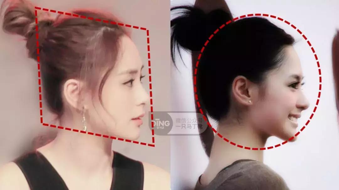 扁头怎么让头变得饱满些,扁头怎么办最快最有效