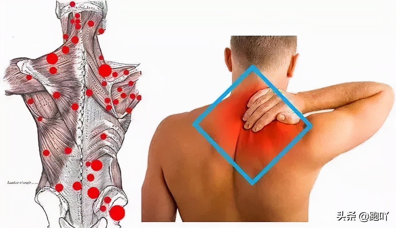 跑后肩部疼痛最快缓解方法,肩颈酸痛是什么原因