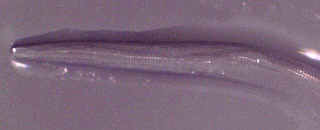 除了近距离接触宠物,不小心碰到苍蝇也可能让你眼中长虫