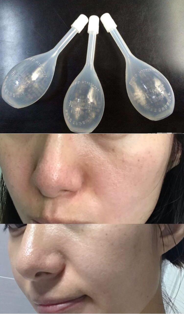 日本49岁贵妇为去皱，坚持用“开塞露”抗老长达20年，现今啥样？