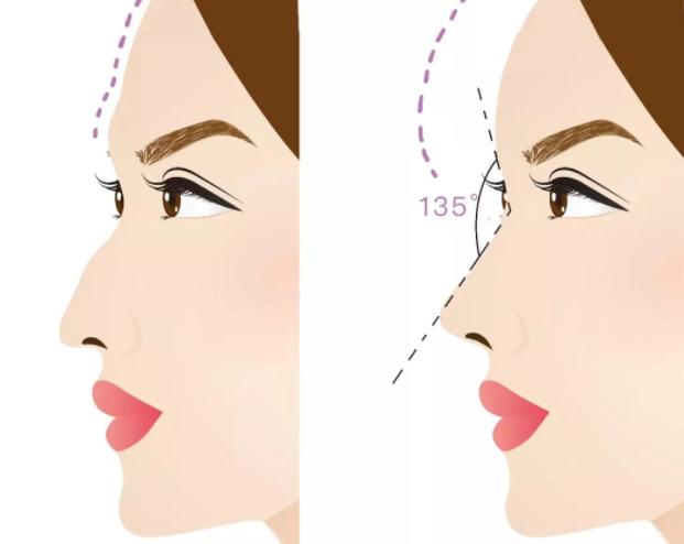 如何让侧颜变得好看,想拥有更好的线条