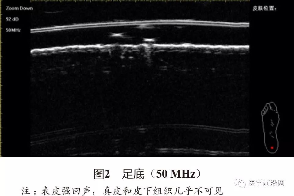 常见皮肤病高频皮肤超声诊断专家共识全文发布