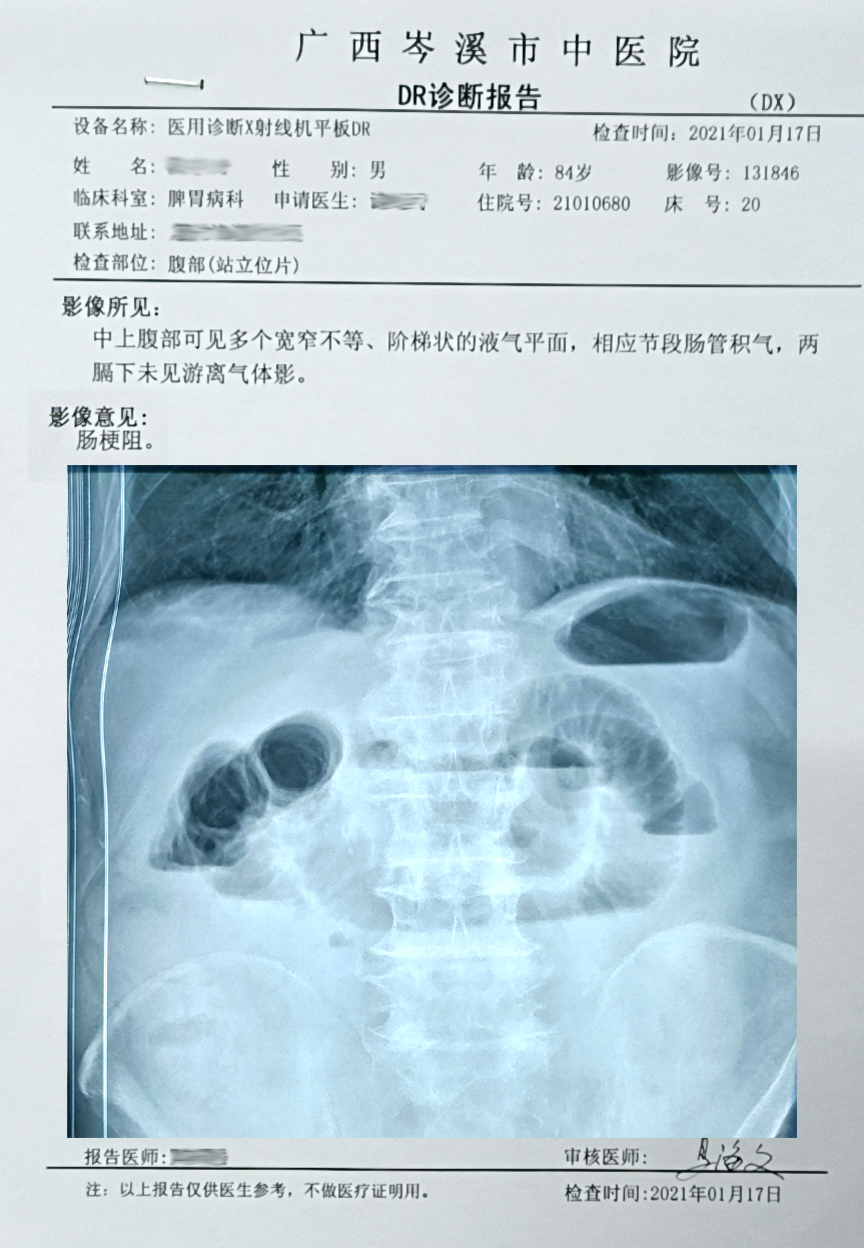 柿子引发的肠梗阻,柿饼为什么会导致肠梗阻