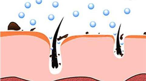 脸上爱出油怎么调理最有效,脸上一直出油怎么控油