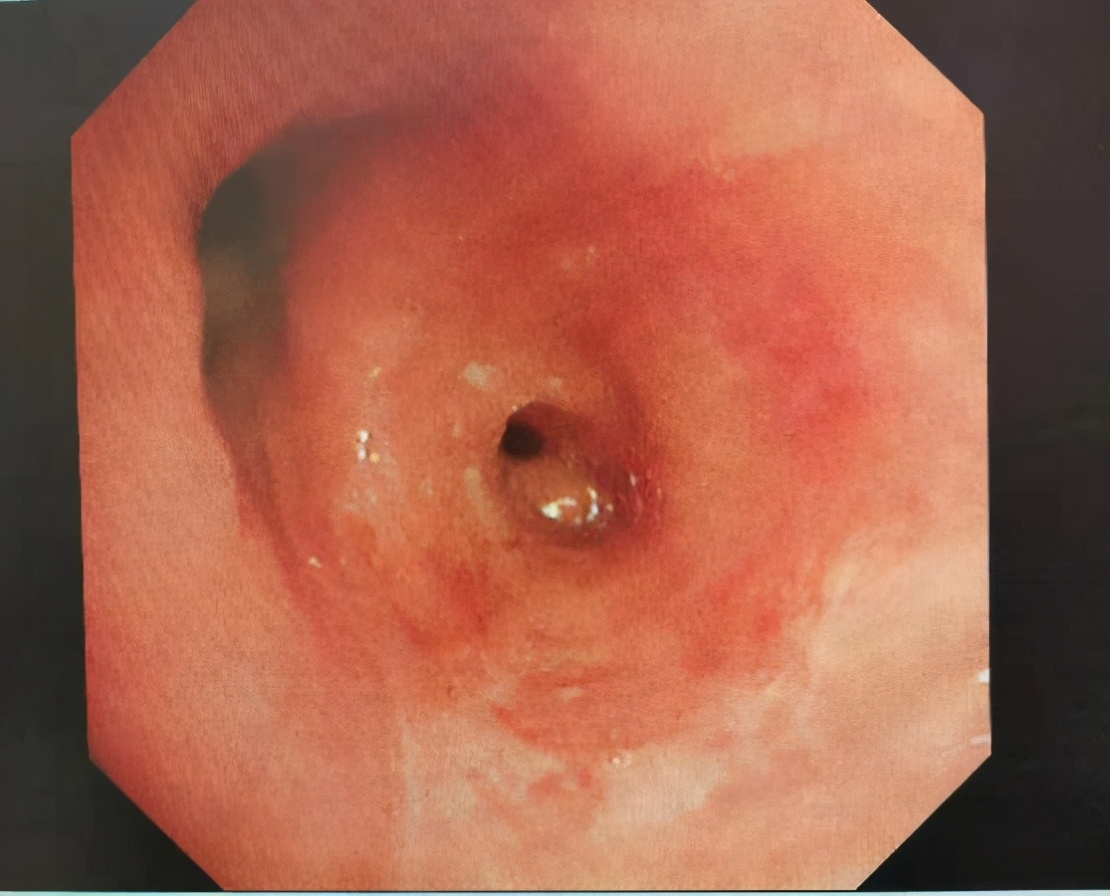呼吸与危重症医学科,呼吸与危重症医学科主治医师