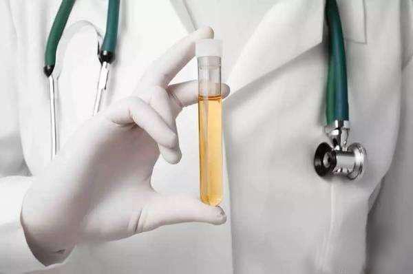 尿管怎么引流,尿管不通畅如何冲洗