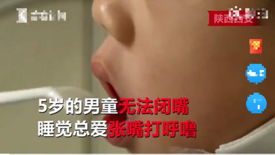 5岁男童张嘴睡觉用嘴呼吸正常吗,小孩反复张嘴闭嘴