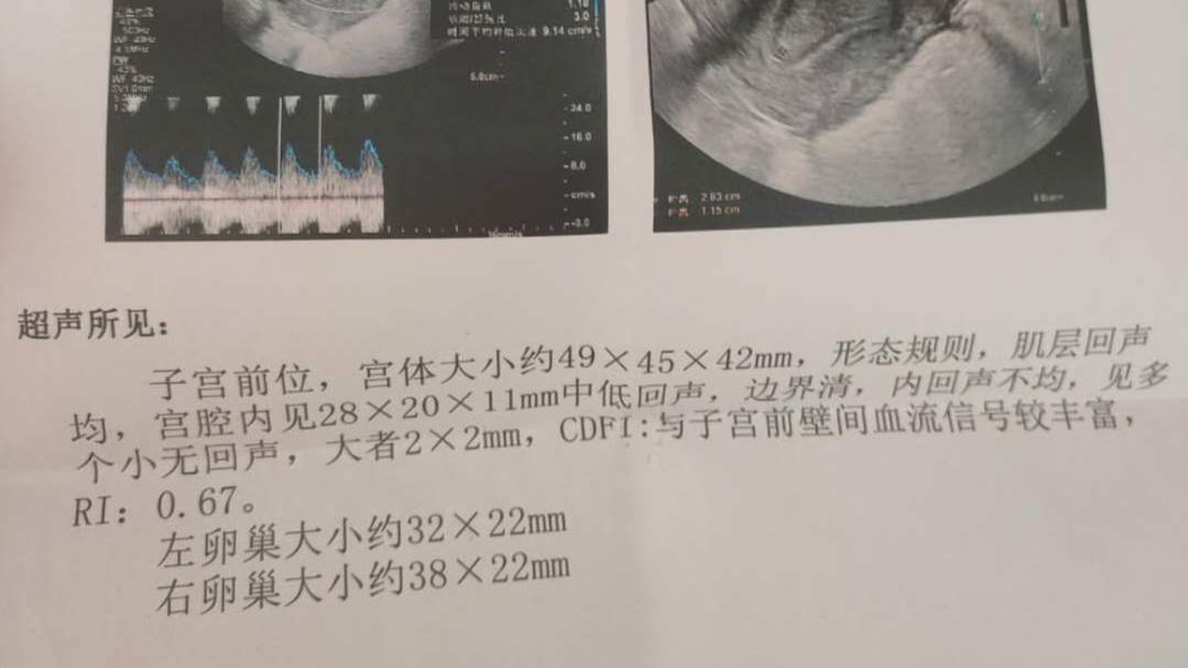 生完孩子体质变差，落下一身月子病，导致疼痛至今，该怎么办