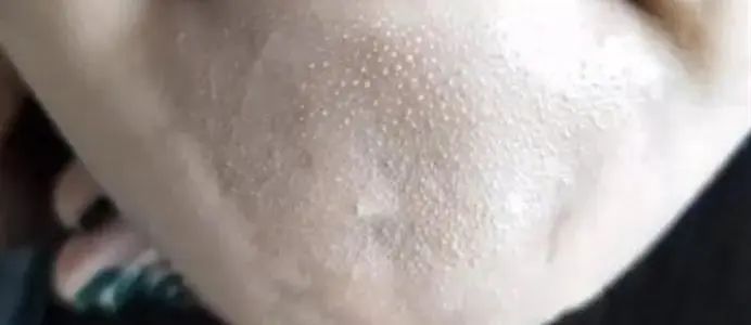 春雨蜂蜜面膜真实测评,春雨蜂蜜面膜用法及功效