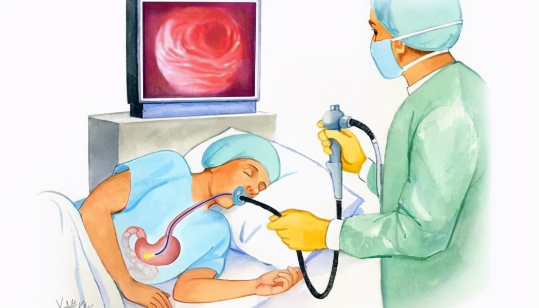 40岁以上的人胃镜多久检查一次,40多岁了有必要一年一次胃镜吗