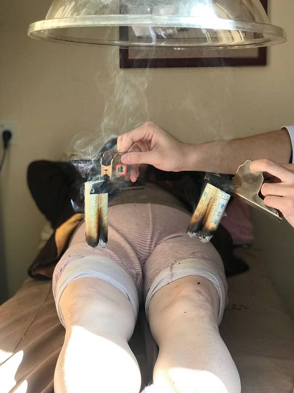 中医针灸膝关节功能恢复,膝关节病针灸视频