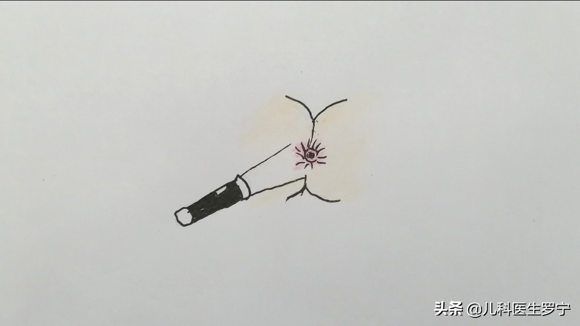 孩子常说屁股痒该做什么检查,孩子总说屁股痒需要驱虫吗