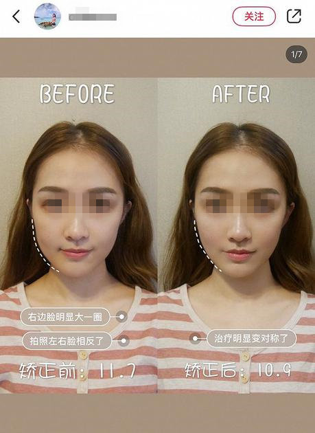 小颜整骨瘦脸手法,小颜整骨瘦脸视频