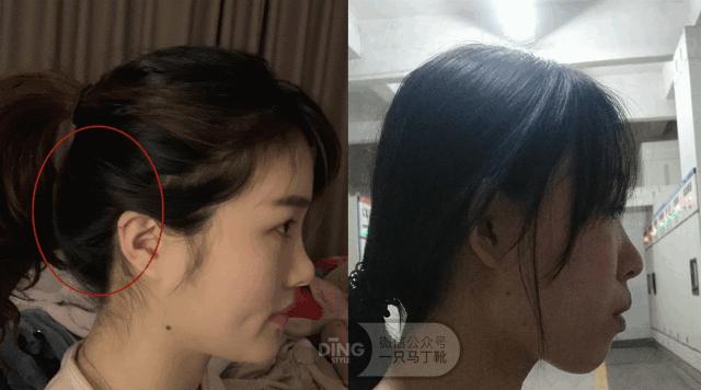 扁头怎么让头变得饱满些,扁头怎么办最快最有效