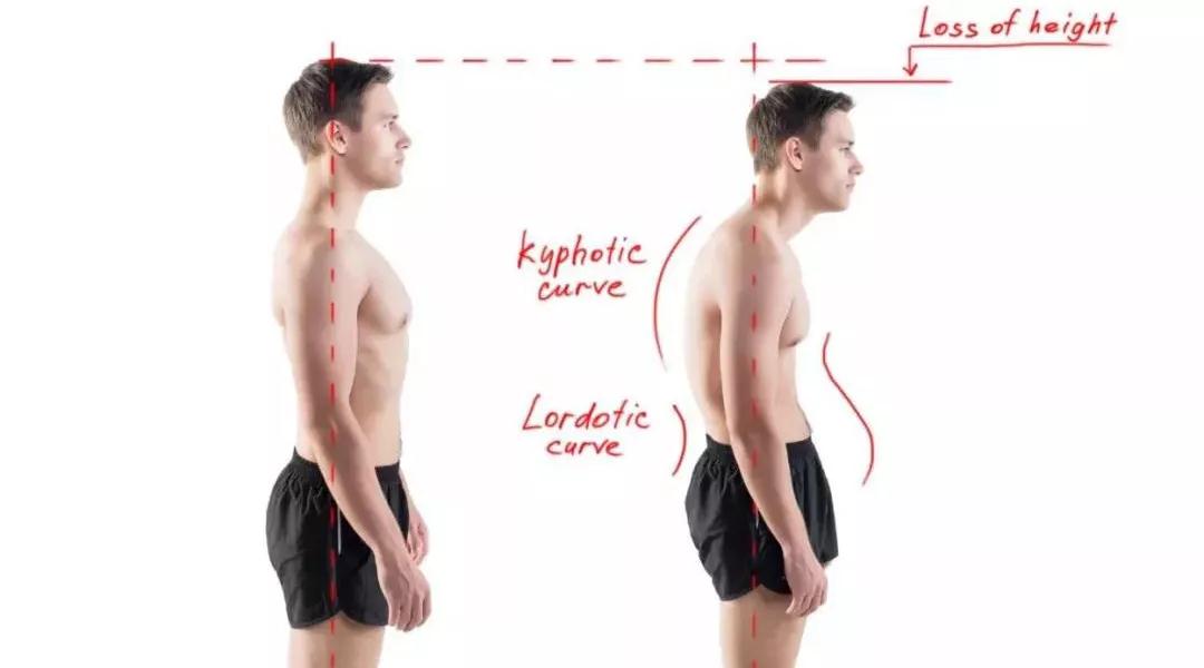 3个让人变丑的动作,容易变胖的姿势