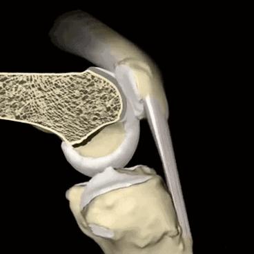 骨关节炎吃药可以做理疗吗,退化性骨关节炎需要终身服药吗