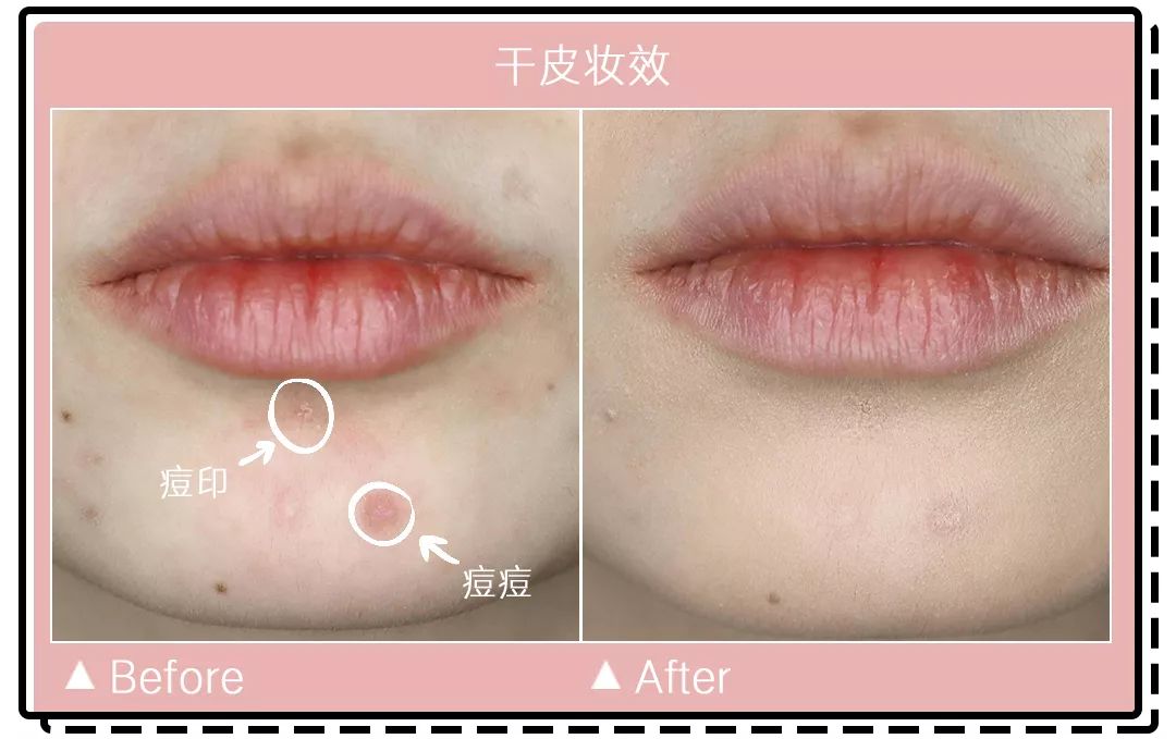 十大公认好用的混油皮粉底液排名,珀莱雅粉底液适合干皮还是油皮