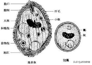 甲硝唑片的说明书用量看不懂,甲硝唑片的适应证有哪些