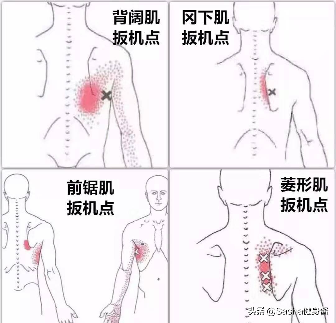 全身肌肉都痛是怎么回事,全身肌肉痛是什么病