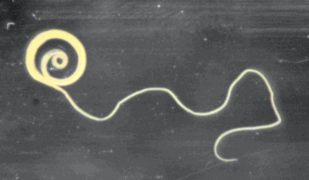 他们生吞3500寄生虫卵,花费1.5万元,只为治疗秃头