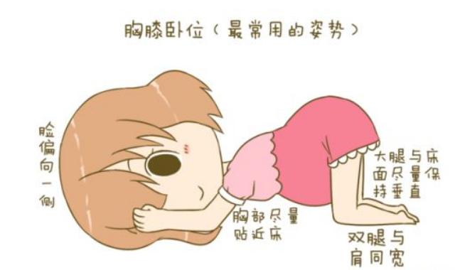 孕晚期胎位不正怎么纠正最快,孕晚期胎位不正的原因及纠正方法