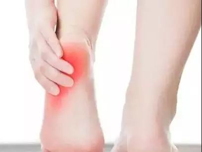 跟腱炎一般多久能自愈,止点性跟腱炎多久恢复