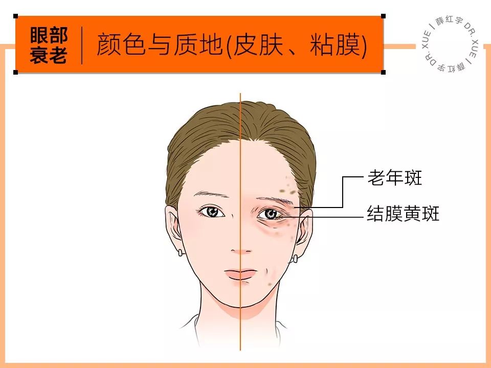 眼部抗衰最好方法,眼部抗衰效果图