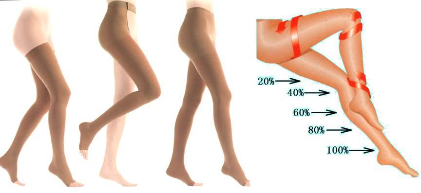 下肢静脉曲张,不怕,医生说可防!可治