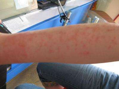 输液出现突发事件怎么办,输液中死亡怎么确认死亡原因