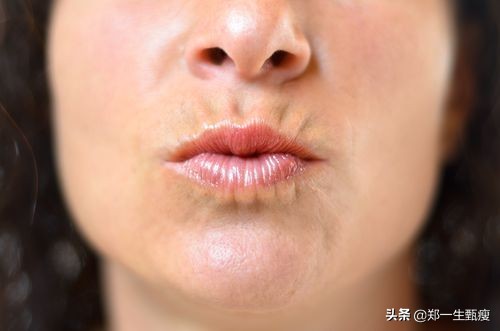 如何摆脱脸颊上的肉肉,如何摆脱下巴脂肪