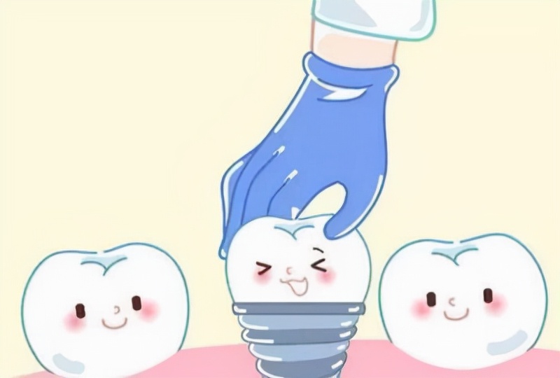 种植牙你不知道的那些事,牙齿里的那些事儿