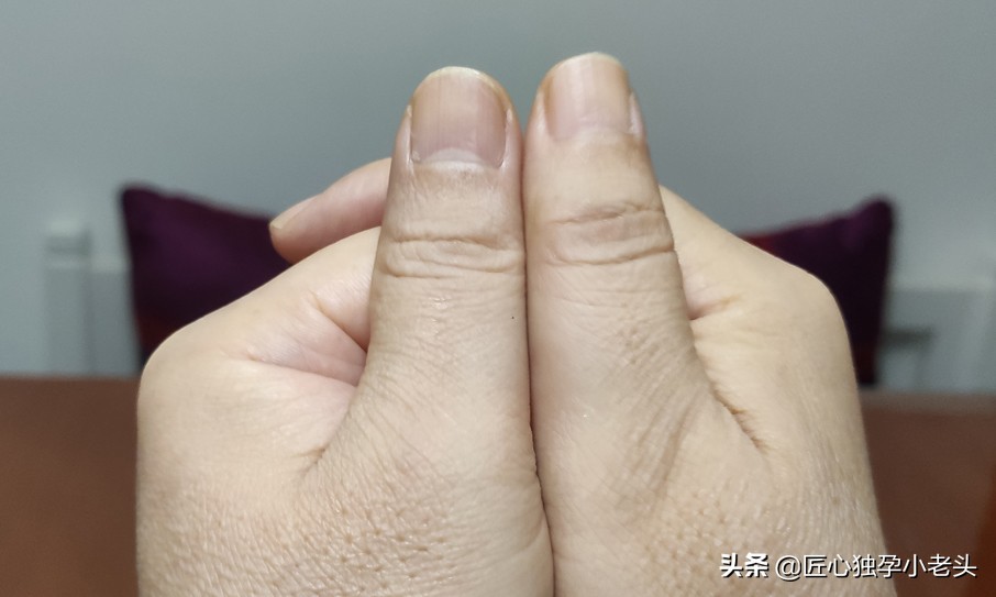 儿童为什么腿长身体短,儿童腿一长一短是正常还是不正常