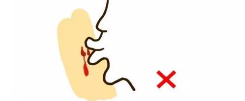 被毒蛇咬伤，一个正确的处理能挽救一条生命！您知道吗？如何防治