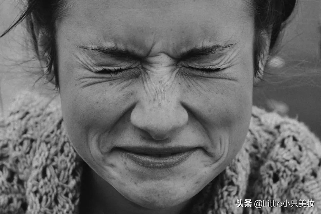 去眼纹打肉毒素吗,去眼纹打多少肉毒素合适