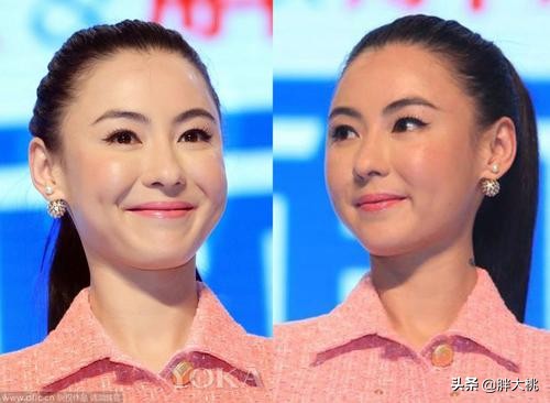 萧亚轩是不是打了玻尿酸一眼便知，明星没有玻尿酸会怎么样？