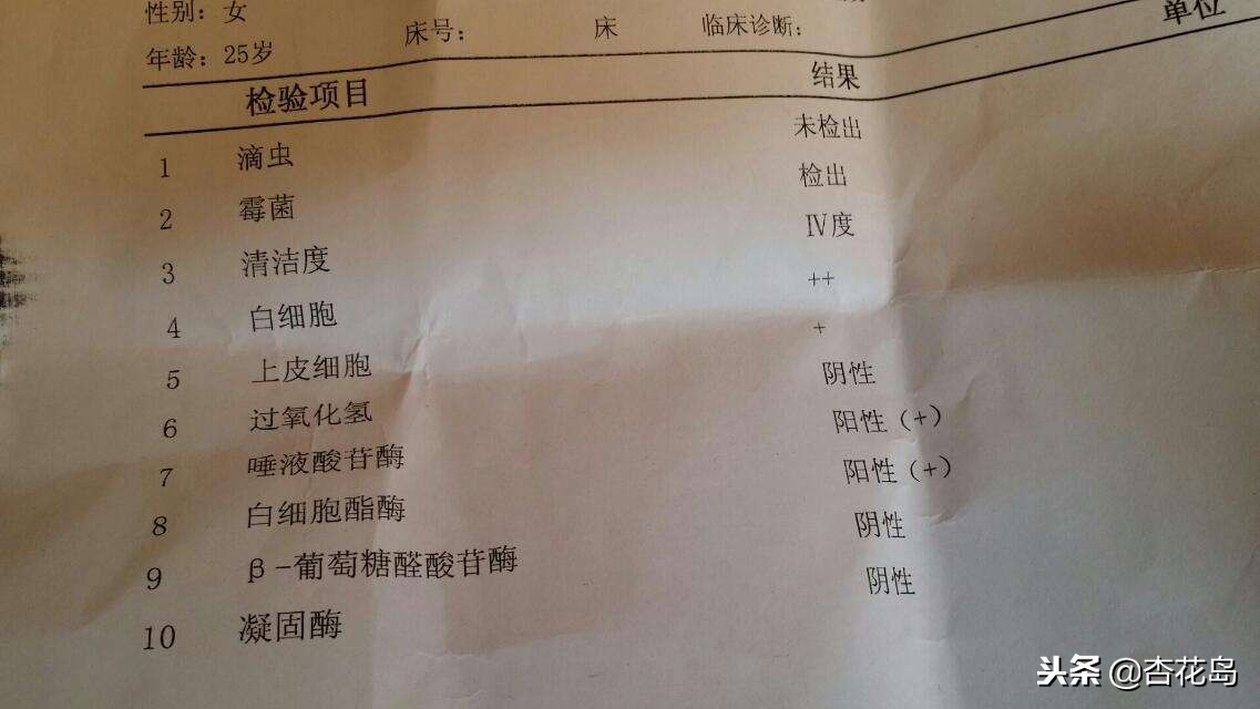 白带检查有什么作用,化验白带能查出一些什么