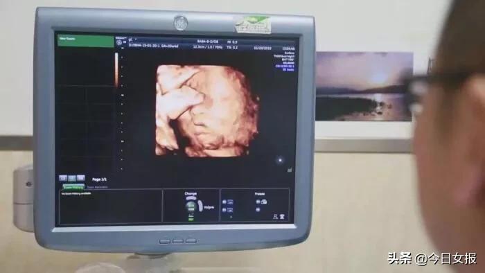 中国首例女儿移植妈妈子宫,中国首例试管婴儿的孩子