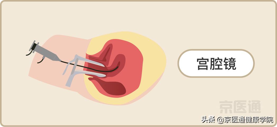 升结肠0.4息肉是癌的可能性是多少,胃体多发息肉0.2-0.4是癌吗