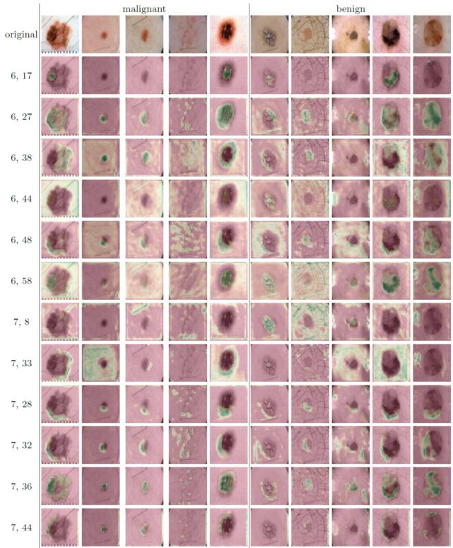 浅谈医学影像学习与实践,基于深度学习的医学影像研究思路