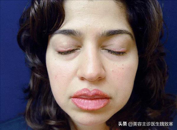 韩式纹眉有哪些种类,韩式纹眉痛吗