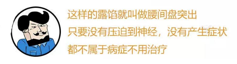此文章让你彻底明白什么是:腰间盘突出