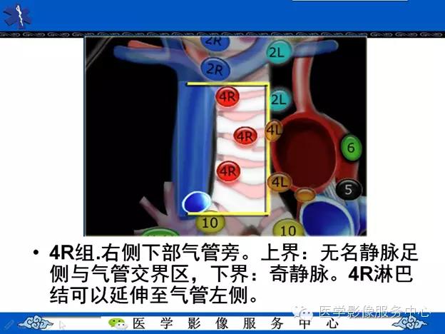 纵隔囊肿影像学表现,纵隔囊肿心包囊肿