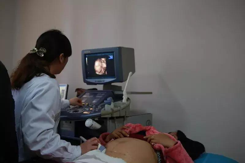 彩超怎么在屏幕上看是黑白的,为什么我的彩超是黑白色