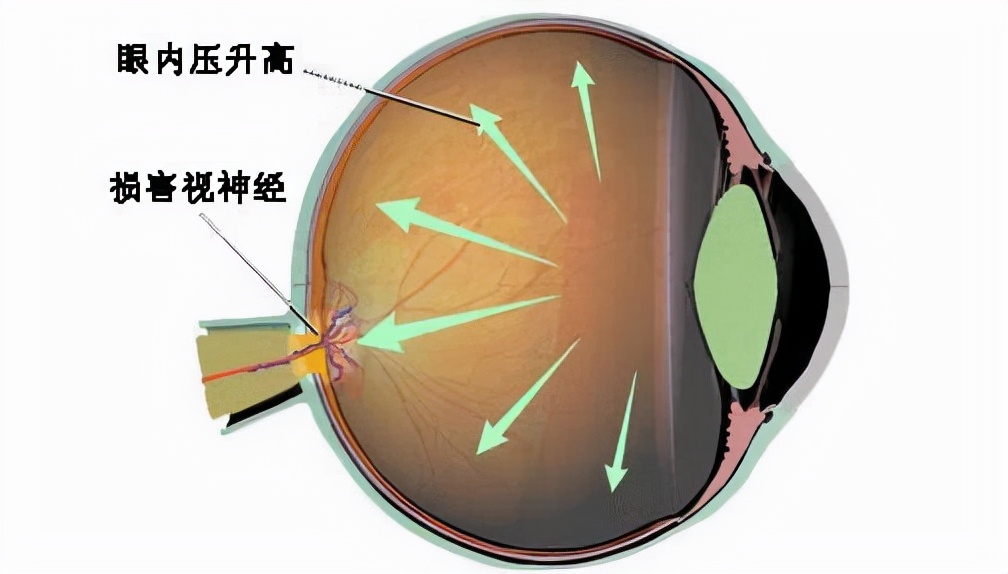 人的眼球发红是怎么回事,外伤引起的眼球充血多久能好