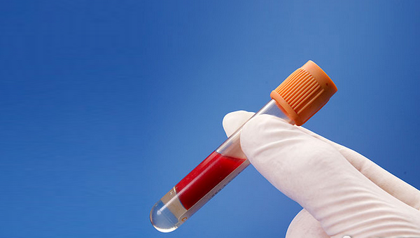 得了高血脂该怎么办啊,得了血脂高吃什么食物好