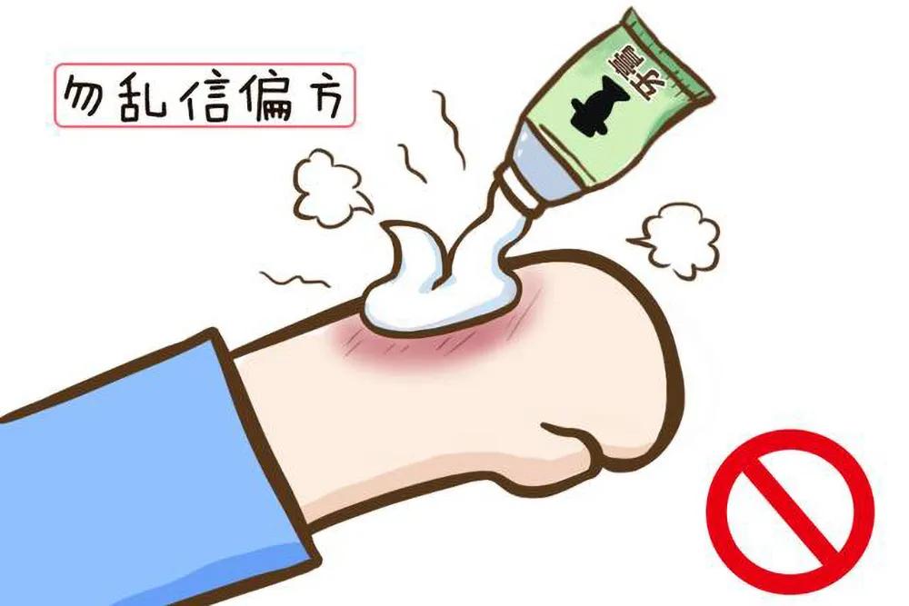 小孩大面积烫伤治疗费用多少,儿童烫伤住院费用