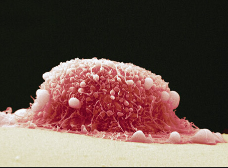 剖腹产你必须知道的几件事,剖腹产有什么知识