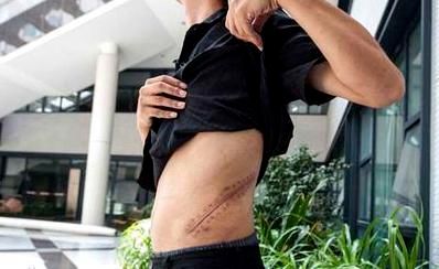 女孩卖卵,男孩卖肾,年龄最小14岁:拿命换钱,却不忍骂孩子虚荣