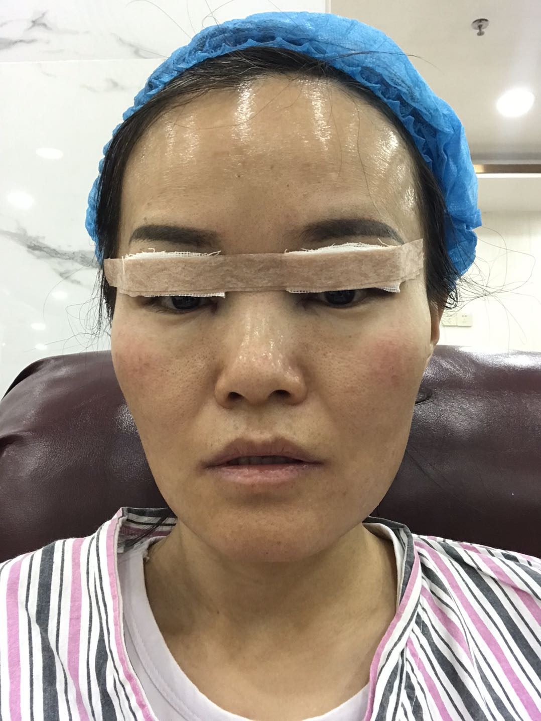 男的割双眼皮好看吗,割双眼皮好看吗动画